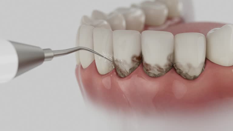 Trusted Invisalign Clear Aligners service in Fort Stockton, TX - Dentist Open Now